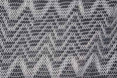 Tipos de mosquiteras para ventanas de aluminio
